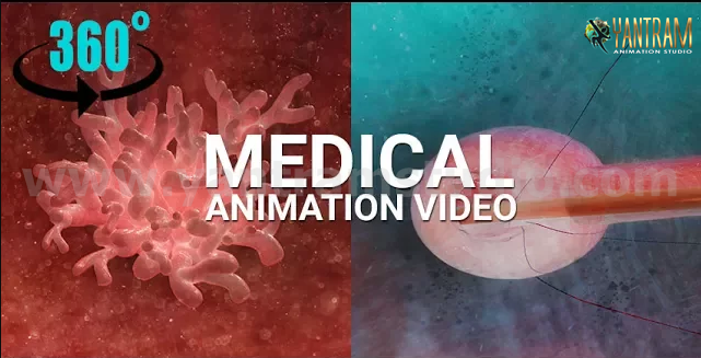 Medical-Animation